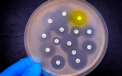 PFSCM delivers first shipments of specialized AMR surveillance products to strengthen laboratory capacity in Africa