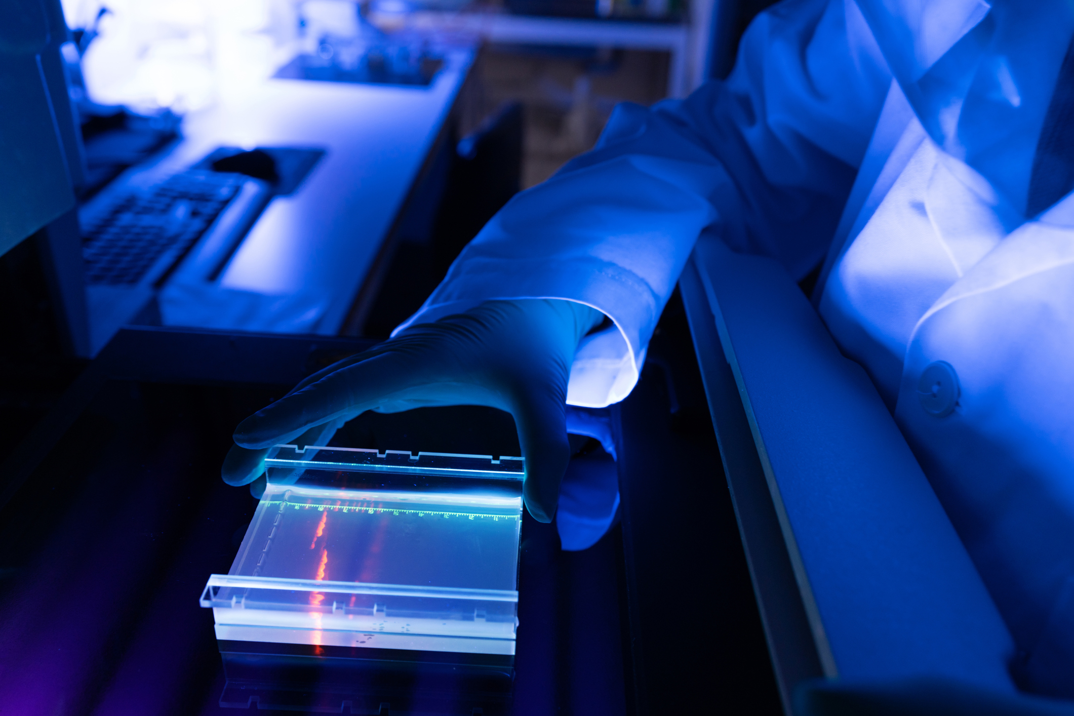 SCMS Central Medical Stores_Botswana_Gaborone