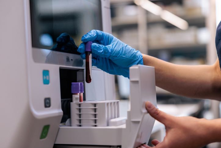 Gloved hands loading samples into a diagnostic instrument